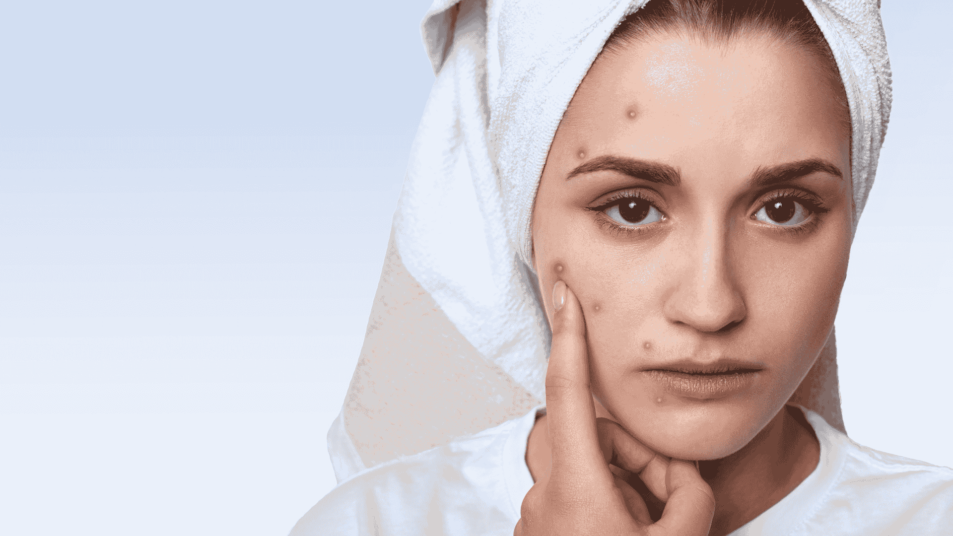 pakai handuk bikin jerawat