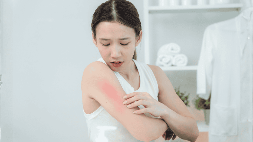 handuk biar tidak gatal